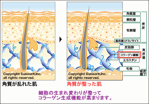 サンソリット　皮膚科　ピーリング石鹸